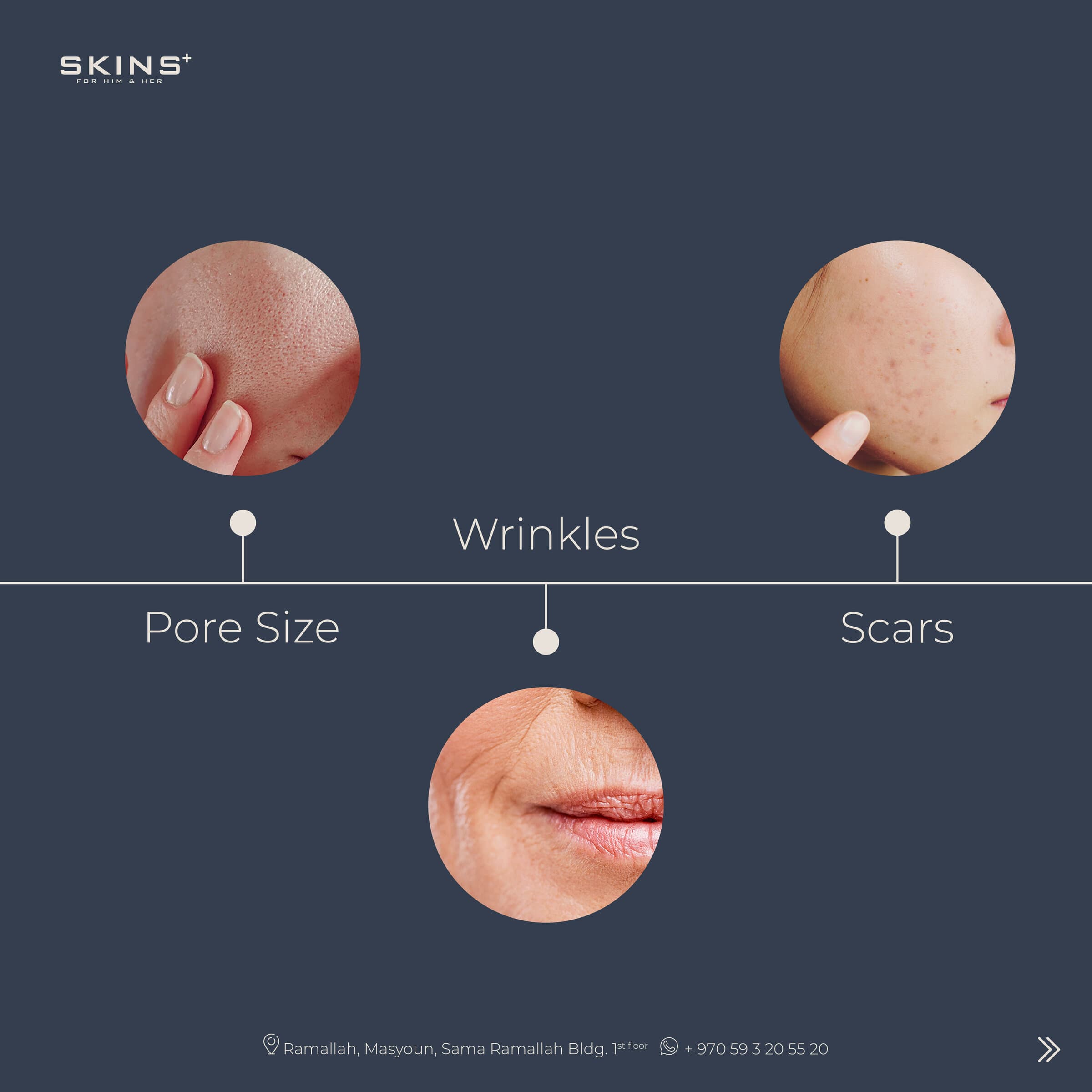 SKINS+ posts — 2