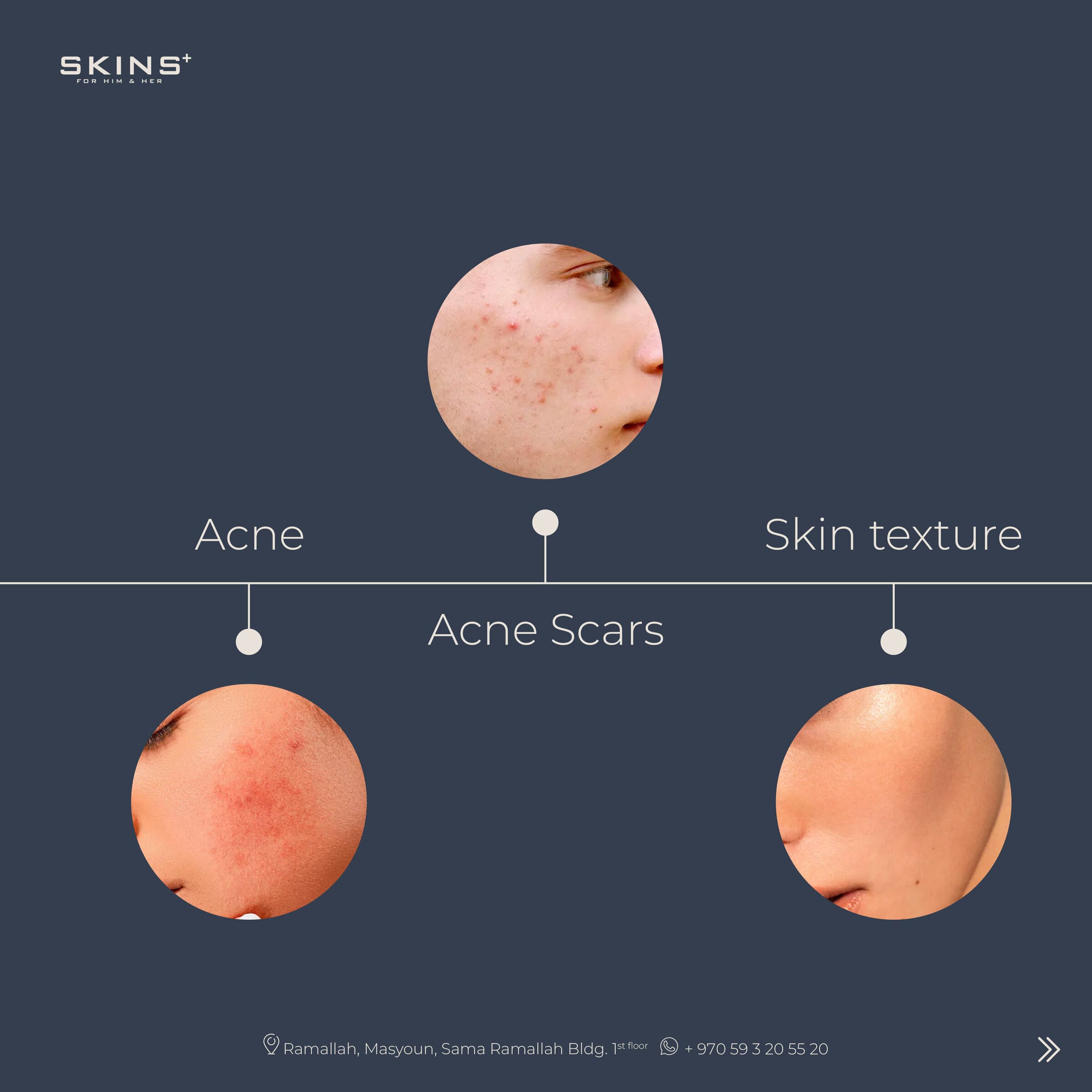SKINS+ posts — 3